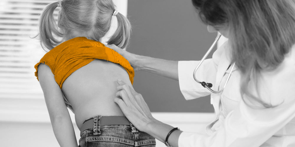 Scoliosis screening Canberra