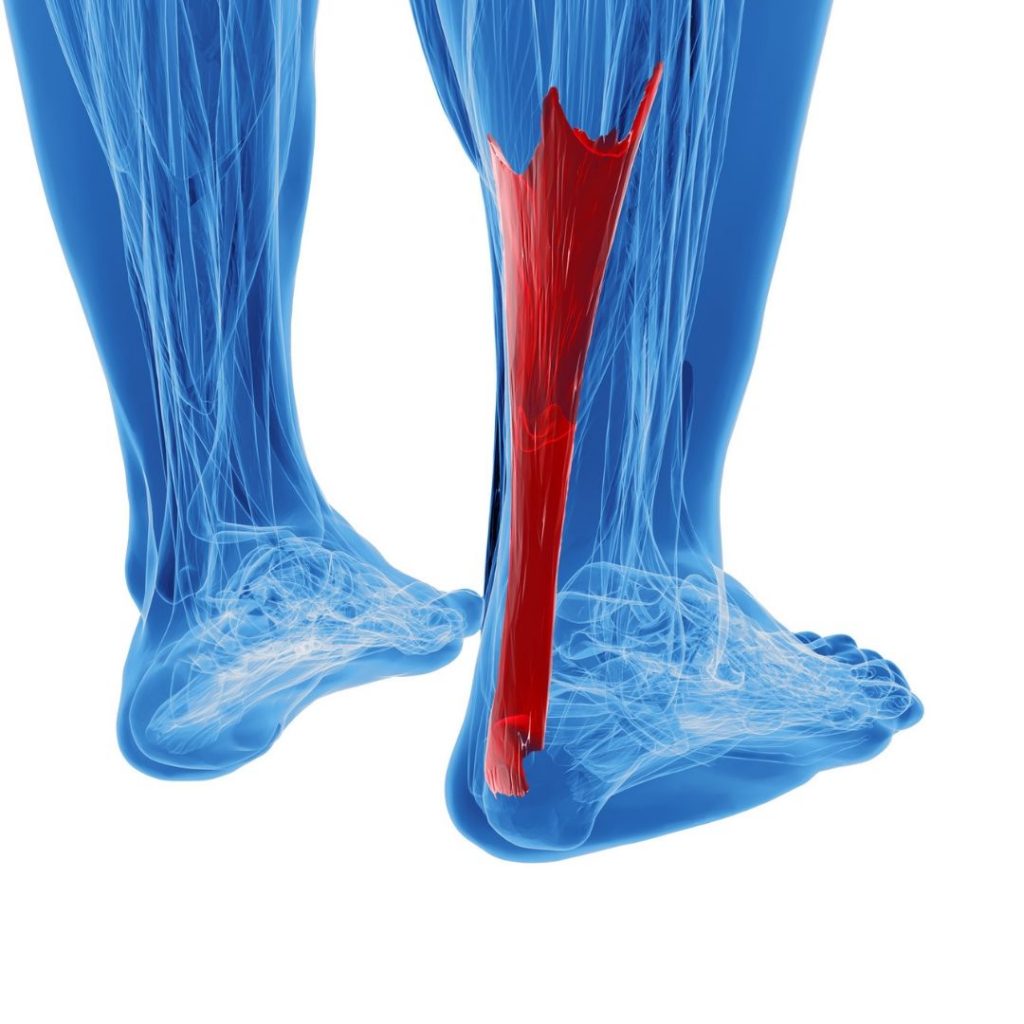 achilles tendonitis calf pain