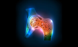 Osteoporosis Fact Sheet