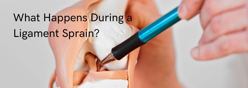 What Happens During a Ligament Sprain?