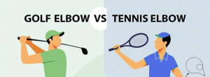 Tennis vs Golfer’s Elbow