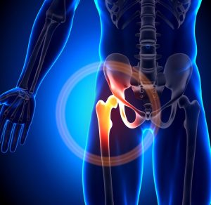 Hip Rehab